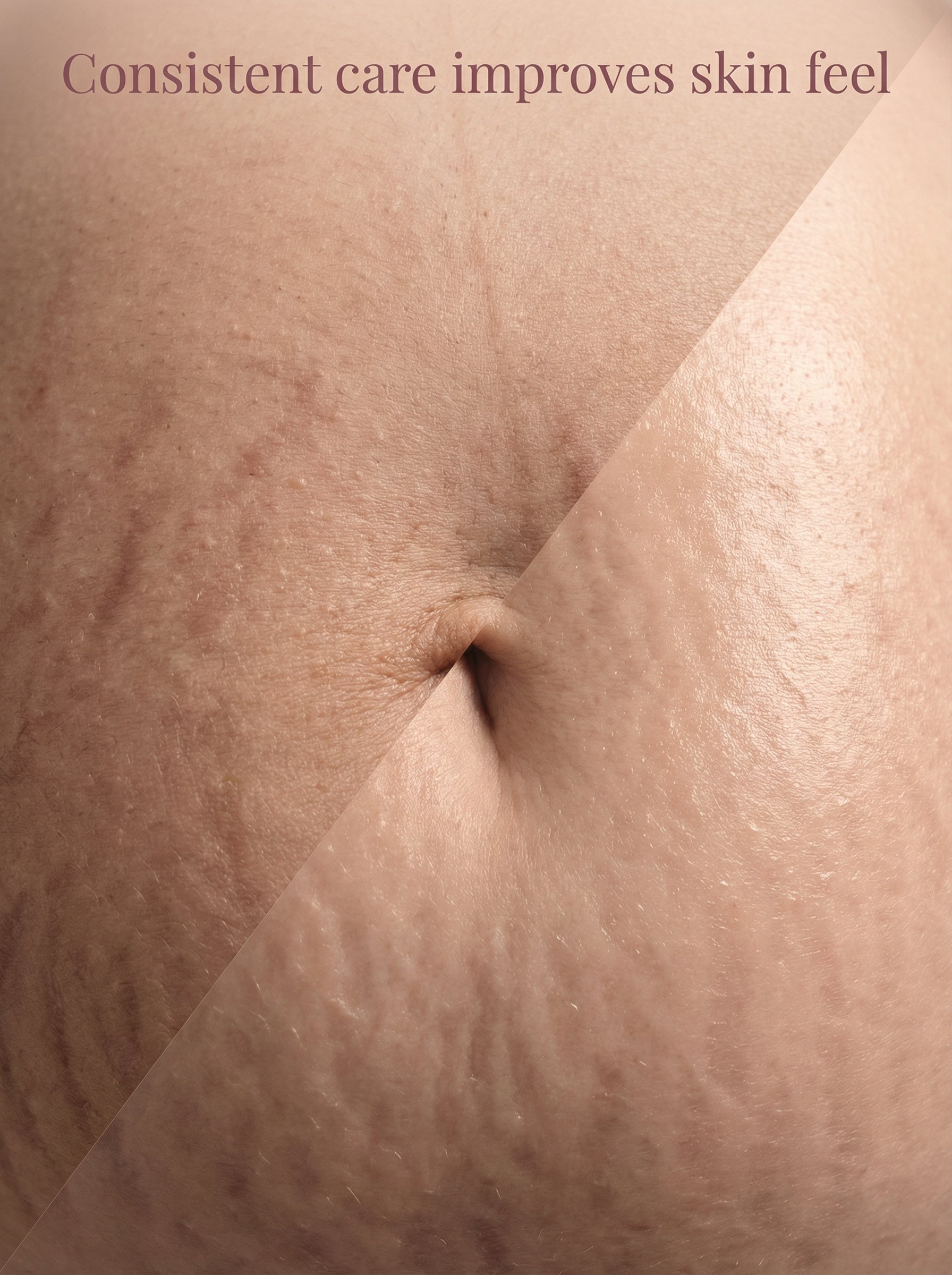 The BelleVie South Moon Pregnancy & Postpartum Skin Firming & Hydration Body Cream